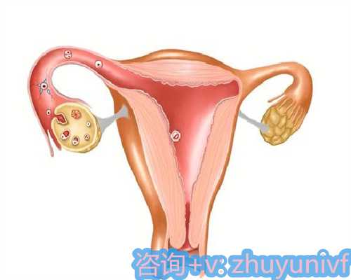 泰国试管婴儿技术是怎么养囊的？